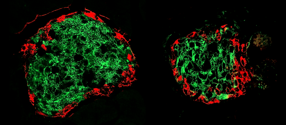 Quando il diabete inizia a svilupparsi nell'individuo prima che i sintomi siano ancora visibili una parte delle cellule beta del pancreas (in verde) scompare (a destra) rispetto ad un individuo sano (a sinistra). Immagine UNIGE, Laboratoire du Prof. Pierre Maechler.